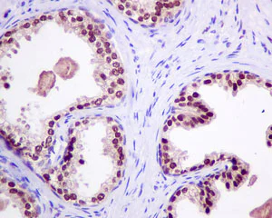 Immunohistochemistry (Formalin/PFA-fixed paraffin-embedded sections) - Anti-RBM47 antibody [EPR9659] - BSA and Azide free (AB249076)