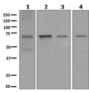 Western blot - Anti-RBM47 antibody [EPR9659] - BSA and Azide free (AB249076)