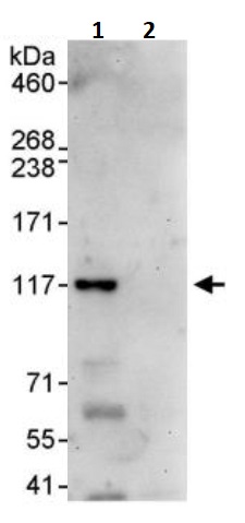 Immunoprecipitation - Anti-RBM5 antibody (AB245646)