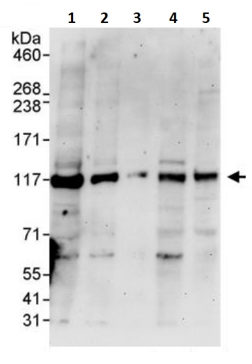 Western blot - Anti-RBM5 antibody (AB245646)