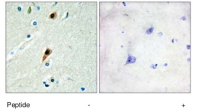 Immunohistochemistry (Formalin/PFA-fixed paraffin-embedded sections) - Anti-RBM5 antibody (AB69770), expandable thumbnail