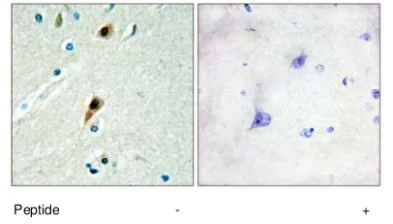 Immunohistochemistry (Formalin/PFA-fixed paraffin-embedded sections) - Anti-RBM5 antibody (AB69770)