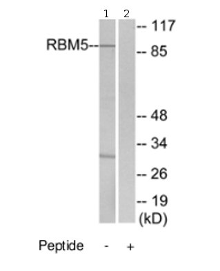 Western blot - Anti-RBM5 antibody (AB69770), expandable thumbnail