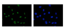 Immunocytochemistry/ Immunofluorescence - Anti-RBM6 antibody [EPR15842] - C-terminal (AB188318)