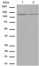 Western blot - Anti-RBM6 antibody [EPR15842] - C-terminal (AB188318)