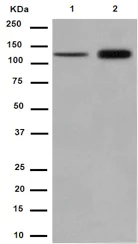 Western blot - Anti-RBM6 antibody [EPR15842] - C-terminal (AB188318)