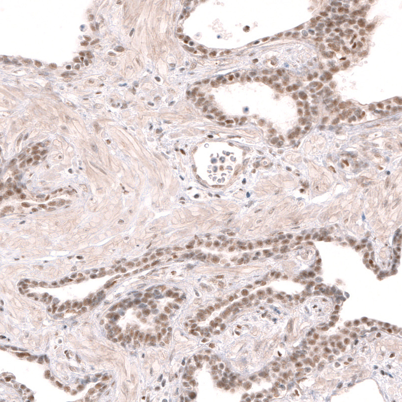 Immunohistochemistry (Formalin/PFA-fixed paraffin-embedded sections) - Anti-RBM7 antibody (AB262917), expandable thumbnail