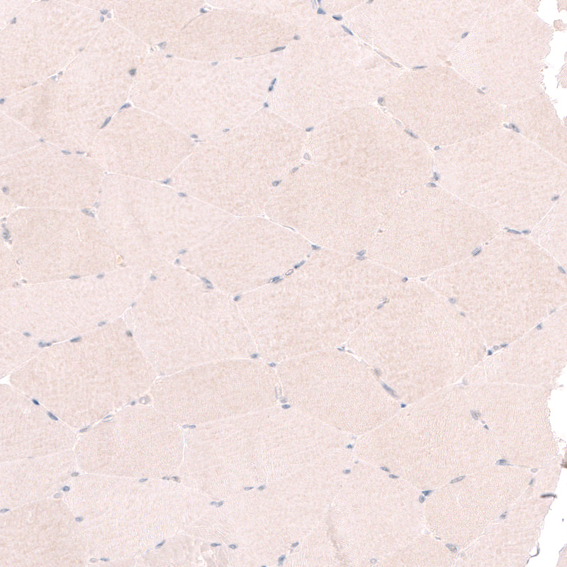 Immunohistochemistry (Formalin/PFA-fixed paraffin-embedded sections) - Anti-RBM7 antibody (AB262917), expandable thumbnail