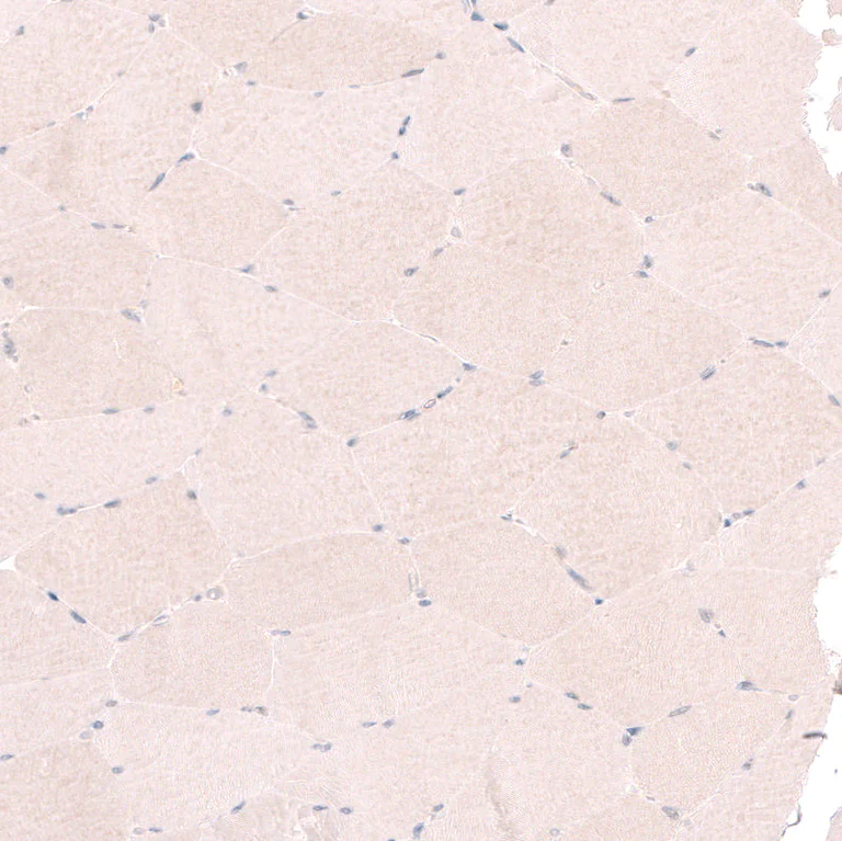 Immunohistochemistry (Formalin/PFA-fixed paraffin-embedded sections) - Anti-RBM7 antibody (AB262917)