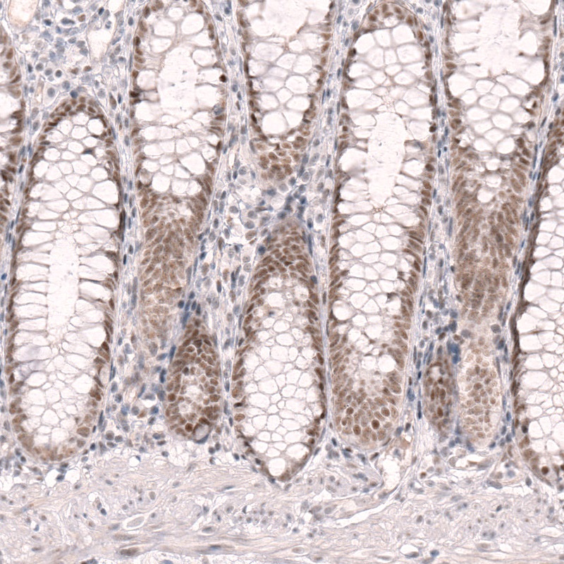 Immunohistochemistry (Formalin/PFA-fixed paraffin-embedded sections) - Anti-RBM7 antibody (AB262917), expandable thumbnail