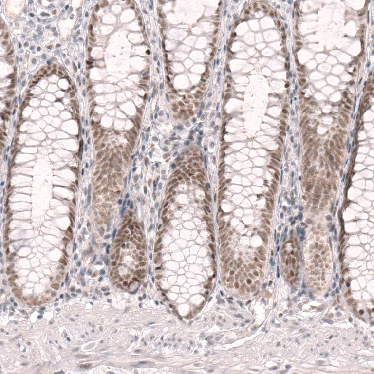 Immunohistochemistry (Formalin/PFA-fixed paraffin-embedded sections) - Anti-RBM7 antibody (AB262917)
