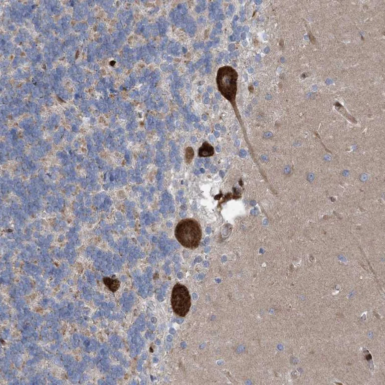 Immunohistochemistry (Formalin/PFA-fixed paraffin-embedded sections) - Anti-RBMS3 antibody (AB272612)