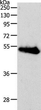 Western blot - Anti-RBMS3 antibody - C-terminal (AB198248)