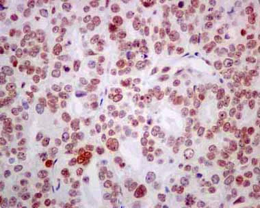 Immunohistochemistry (Formalin/PFA-fixed paraffin-embedded sections) - Anti-RBMX2 antibody [EPR14394] (AB180940)
