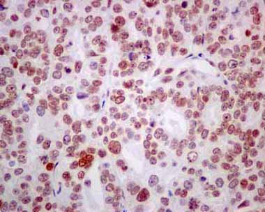 Immunohistochemistry (Formalin/PFA-fixed paraffin-embedded sections) - Anti-RBMX2 antibody [EPR14394] - BSA and Azide free (AB250272), expandable thumbnail