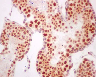 Immunohistochemistry (Formalin/PFA-fixed paraffin-embedded sections) - Anti-RBMX2 antibody [EPR14394] - BSA and Azide free (AB250272)