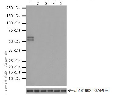 Western blot - Anti-RBMY1A1 antibody [R12508(2)] - BSA and Azide free (AB251302), expandable thumbnail