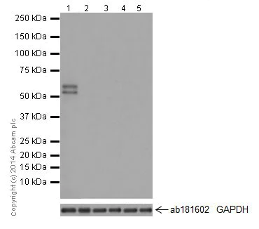 Western blot - Anti-RBMY1A1 antibody [R12508(2)] - BSA and Azide free (AB251302)