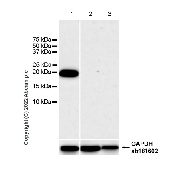 Western blot - Anti-RBP1 antibody [42/RBP] (AB307683)