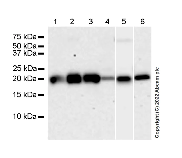 Western blot - Anti-RBP1 antibody [42/RBP] (AB307683)