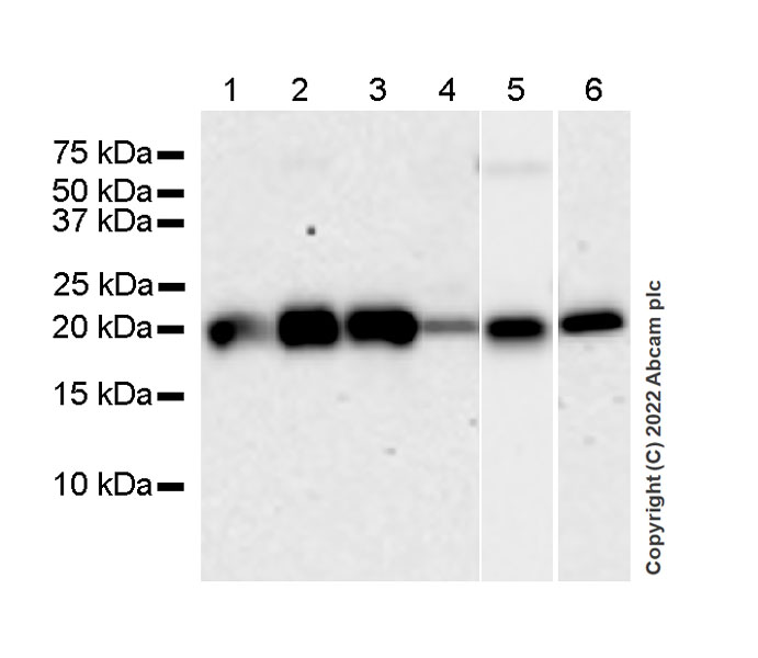 Western blot - Anti-RBP1 antibody [42/RBP] - BSA and Azide free (AB307684)