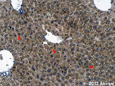 Immunohistochemistry (Formalin/PFA-fixed paraffin-embedded sections) - Anti-RBP1 antibody (AB104452)