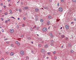 Immunohistochemistry (Formalin/PFA-fixed paraffin-embedded sections) - Anti-RBP1 antibody (AB104452)