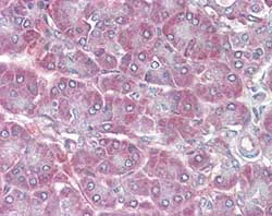 Immunohistochemistry (Formalin/PFA-fixed paraffin-embedded sections) - Anti-RBP1 antibody (AB104452)
