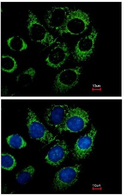 Immunocytochemistry/ Immunofluorescence - Anti-RBP1 antibody (AB154881), expandable thumbnail