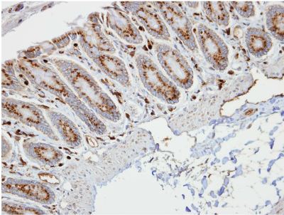 Immunohistochemistry (Formalin/PFA-fixed paraffin-embedded sections) - Anti-RBP1 antibody (AB154881), expandable thumbnail