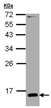 Western blot - Anti-RBP1 antibody (AB154881), expandable thumbnail