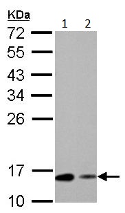 Western blot - Anti-RBP1 antibody (AB154881), expandable thumbnail