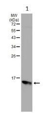 Western blot - Anti-RBP1 antibody (AB154881)