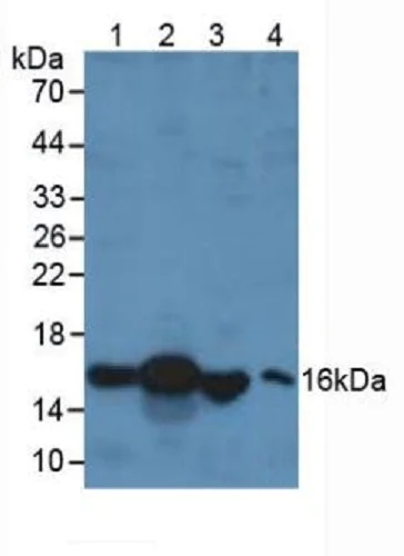 Western blot - Anti-RBP1 antibody (AB233296)