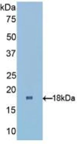 Western blot - Anti-RBP1 antibody (AB233296)