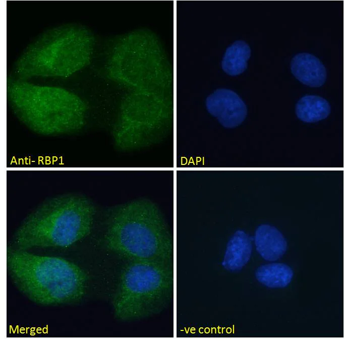 Immunocytochemistry/ Immunofluorescence - Anti-RBP1 antibody (AB31106)