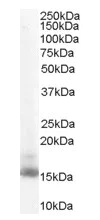 Western blot - Anti-RBP1 antibody (AB31106)