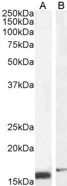Western blot - Anti-RBP1 antibody (AB31106), expandable thumbnail