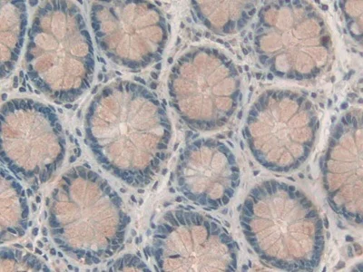 Immunohistochemistry (Formalin/PFA-fixed paraffin-embedded sections) - Anti-RBP2 antibody (AB233514)