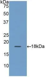 Western blot - Anti-RBP2 antibody (AB233514)