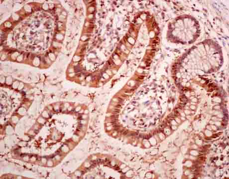 Immunohistochemistry (Formalin/PFA-fixed paraffin-embedded sections) - Anti-RBP2 antibody [EPR12334] (AB180494)