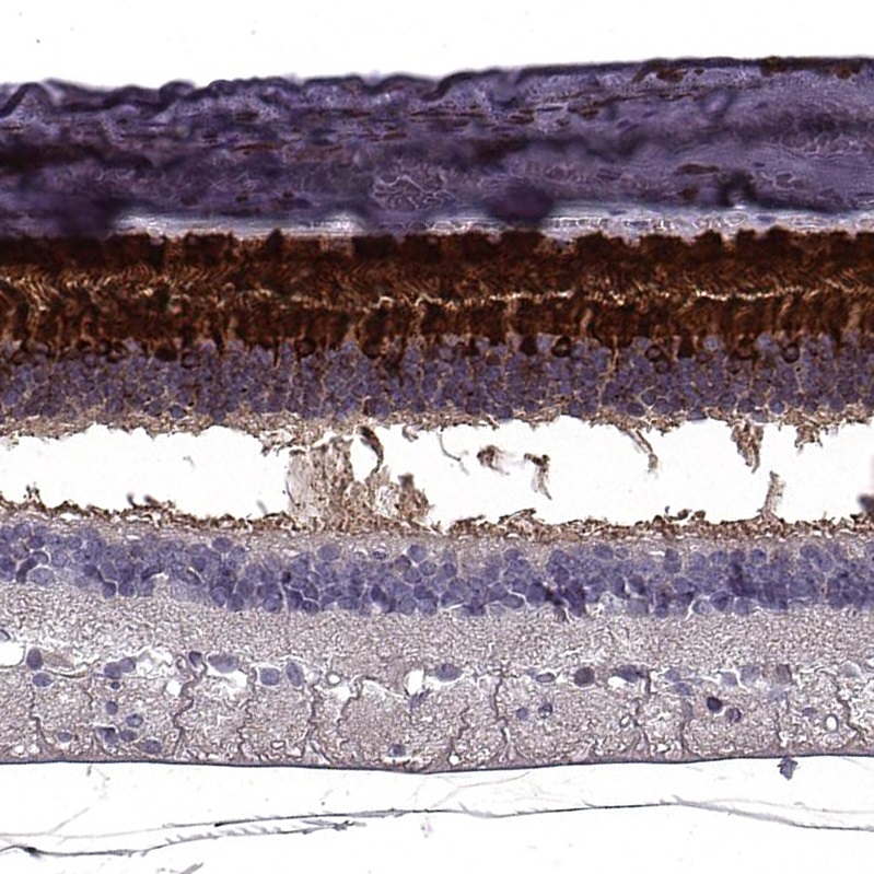 Immunohistochemistry (Formalin/PFA-fixed paraffin-embedded sections) - Anti-RBP3/IRBP antibody (AB222192), expandable thumbnail