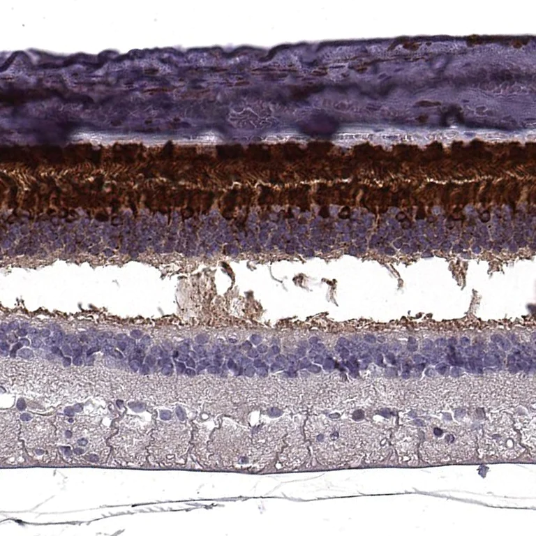 Immunohistochemistry (Formalin/PFA-fixed paraffin-embedded sections) - Anti-RBP3/IRBP antibody (AB222192)