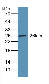Western blot - Anti-RBP3/IRBP antibody (AB233190)