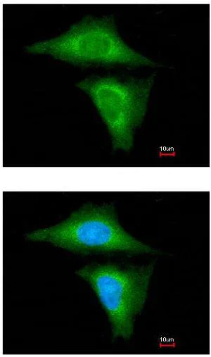 Immunocytochemistry/ Immunofluorescence - Anti-RBP4 antibody (AB154914)