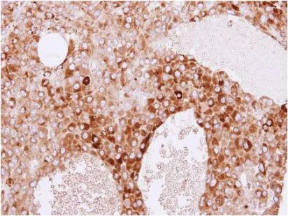 Immunohistochemistry (Formalin/PFA-fixed paraffin-embedded sections) - Anti-RBP4 antibody (AB154914)