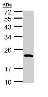 Western blot - Anti-RBP4 antibody (AB154914)
