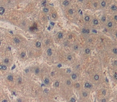 Immunohistochemistry (Formalin/PFA-fixed paraffin-embedded sections) - Anti-RBP4 antibody (AB233138)