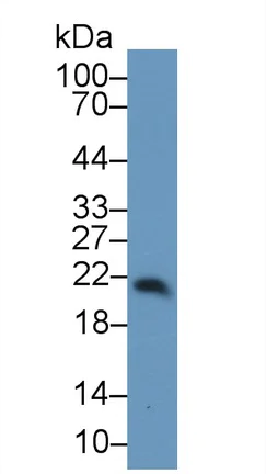 Western blot - Anti-RBP4 antibody (AB233138)