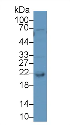 Western blot - Anti-RBP4 antibody (AB233138)
